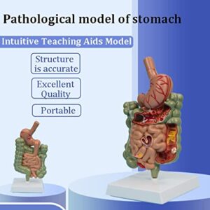 PAASHE Anatomy Model Human Stomach Anatomy Model Organs Model Human Body Model Stomach Section Large Small Intestine Medical Model Study Education