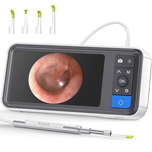 digital otoscope with 4.5 inches screen, anykit 3.9mm ear camera with 6 led lights, 32gb card, ear wax removal tool, specula and 2500 mah rechargeable battery, supports photo snap and video recording