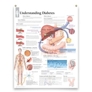 understanding diabetes laminated medical educational informational poster diagram doctors office school classroom 22×28 inches