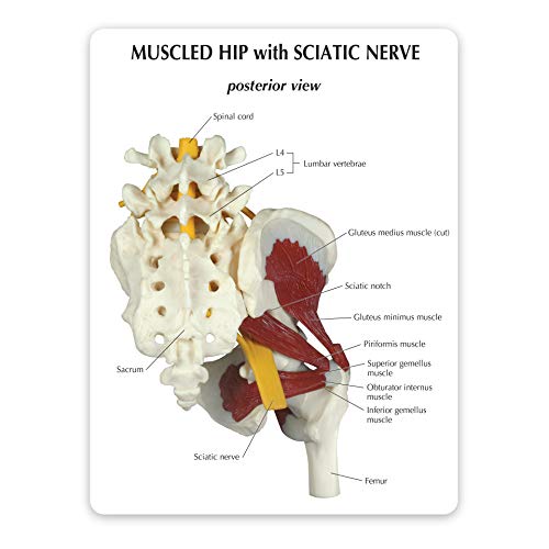 Hip Joint w/Sciatic Nerve Model | Human Body Anatomy Replica of Normal Muscled Hip Joint w/Sciatic Nerve for Doctors Office Educational Tool | GPI Anatomicals