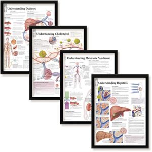 set of 4 framed medical posters understanding diabetes understanding cholesterol understanding metabolic syndrome and understanding hepatitis 22″x28″ wall diagrams