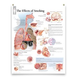 the effects of smoking laminated medical educational informational poster diagram doctors office school classroom 22×28 inches