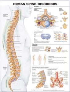 human spine disorders anatomical chart