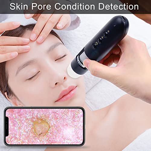 WiFi Connect 500X Scalp Detector for Hair Health, Skin Hair Diagnosis Analyzing High Definition Electronic Microscope Scalp Follicle Detector