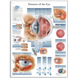 3b scientific vr1231uu glossy paper diseases of the eye anatomical chart, poster size 20″ width x 26″ height