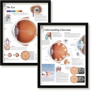 set of 2 framed medical posters the eye and understanding glaucoma 22″x28″ wall diagrams