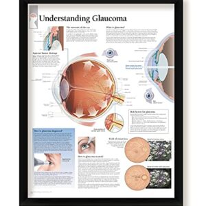 Set of 2 Framed Medical Posters The Eye and Understanding Glaucoma 22"x28" Wall Diagrams