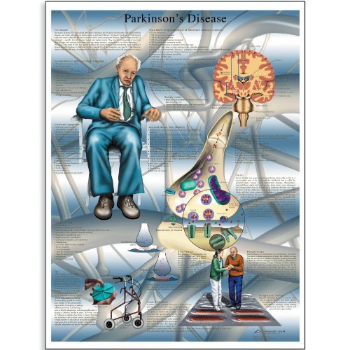 3B Scientific VR1629L Glossy UV Resistant Laminated Paper Parkinson's Disease Anatomical Chart, Poster Size 20" Width x 26" Height