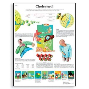 3b scientific vr1452l glossy laminated paper cholesterol anatomical chart, poster size 20″ width x 26″ height