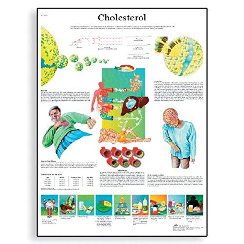 3B Scientific VR1452L Glossy Laminated Paper Cholesterol Anatomical Chart, Poster Size 20" Width x 26" Height