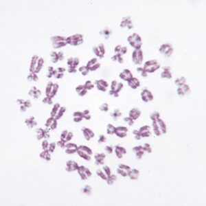 human male chromosomes – 46, xy, spread microscope slide