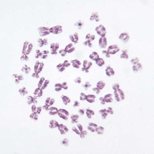 Human Male Chromosomes - 46, XY, Spread Microscope Slide