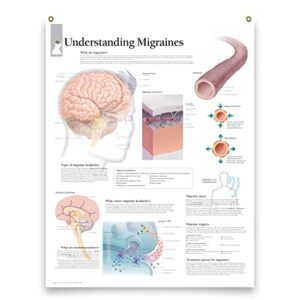 understanding migraines laminated medical educational informational poster diagram doctors office school classroom 22×28 inches