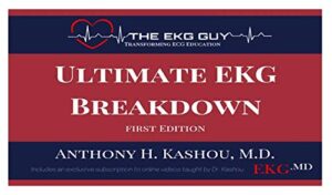 ultimate ekg breakdown – the ekg guy