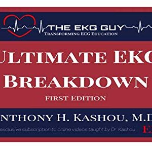 Ultimate EKG Breakdown - The EKG Guy