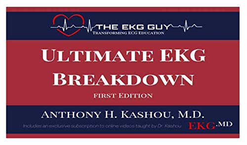 Ultimate EKG Breakdown - The EKG Guy