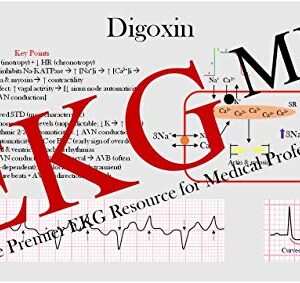 Ultimate EKG Breakdown - The EKG Guy