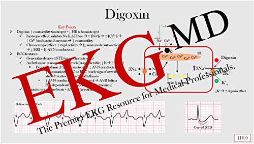 Ultimate EKG Breakdown - The EKG Guy