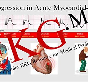 Ultimate EKG Breakdown - The EKG Guy