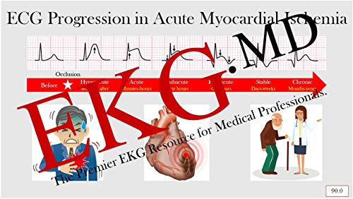 Ultimate EKG Breakdown - The EKG Guy