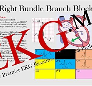 Ultimate EKG Breakdown - The EKG Guy