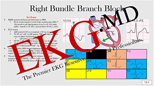 Ultimate EKG Breakdown - The EKG Guy