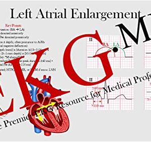 Ultimate EKG Breakdown - The EKG Guy