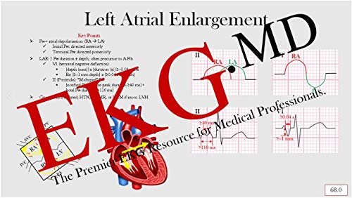 Ultimate EKG Breakdown - The EKG Guy