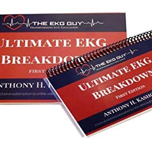 Ultimate EKG Breakdown - The EKG Guy