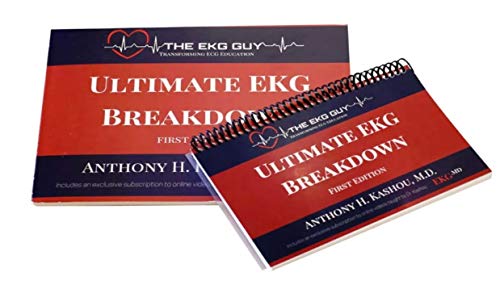 Ultimate EKG Breakdown - The EKG Guy