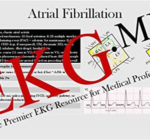 Ultimate EKG Breakdown - The EKG Guy