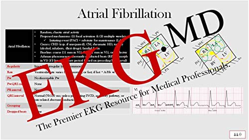 Ultimate EKG Breakdown - The EKG Guy