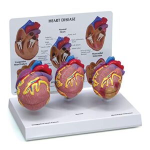 heart model set | human body anatomy replica heart disease set for doctors office educational tool | gpi anatomicals