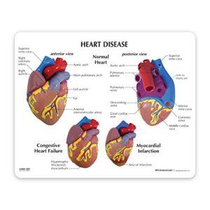 Heart Model Set | Human Body Anatomy Replica Heart Disease Set for Doctors Office Educational Tool | GPI Anatomicals