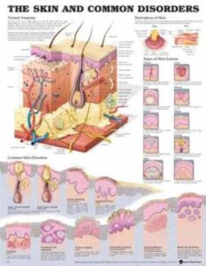 the skin and common disorders anatomical chart