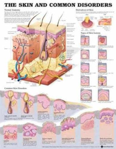 The Skin and Common Disorders Anatomical Chart