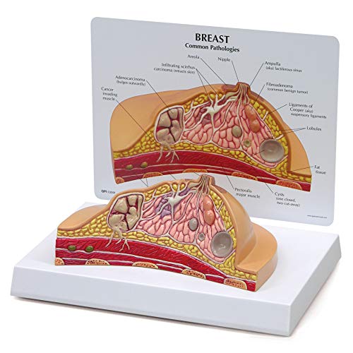 Breast Cross-Section Model | Human Body Anatomy Replica of Breast w/Common Pathologies for Doctors Office Educational Tool | GPI Anatomicals