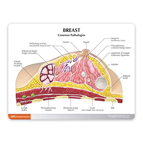 Breast Cross-Section Model | Human Body Anatomy Replica of Breast w/Common Pathologies for Doctors Office Educational Tool | GPI Anatomicals