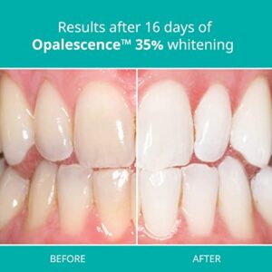 Opalescence at Home Teeth Whitening - Teeth Whitening Gel Syringes - 4 Pack of 35% Syringes - Mint