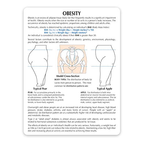 Obesity Model | Human Body Anatomy Replica of Overweight Body Types for Doctors Office Educational Tool | GPI Anatomicals