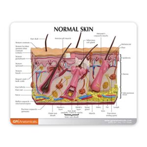 Skin Burn Model | Human Body Anatomy Replica of Varying Degrees of Skin Burn for Dermatology Educational Tool | GPI Anatomicals