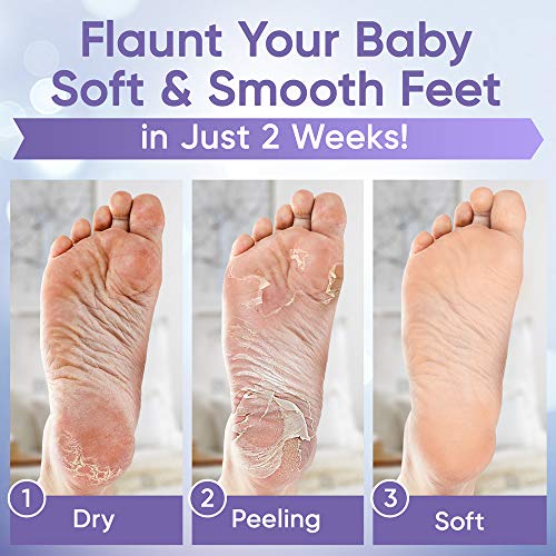 ﻿﻿Foot Peel Mask (2 Pairs) - Foot Mask for Baby soft skin - Remove Dead Skin | Foot Spa Foot Care for women Peel Mask with Lavender and Aloe Vera Gel for Men and Women Feet Peeling Mask Exfoliating