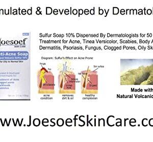 JOESOEF SKIN CARE Sulfur Soap for Acne Pharmaceutical Grade Dermatologists Approved for Acne Rosacea 100G