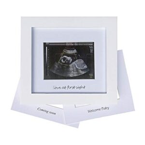 iheipye baby sonogram photo frame – 1st ultrasound picture frame – idea gift for expecting parents,baby shower, gender reveal party,baby nursery decor (silver text, white)