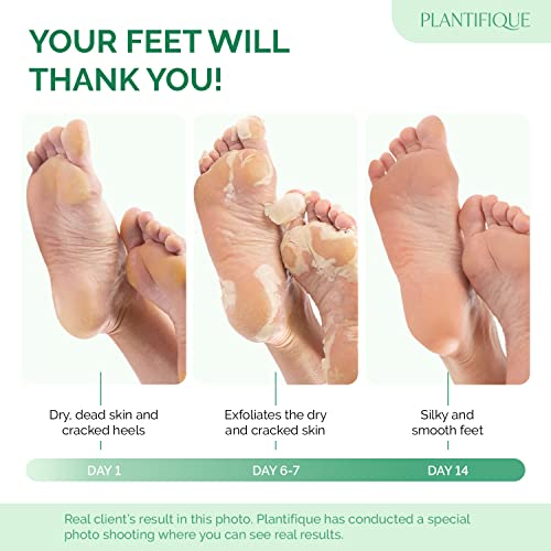 PLANTIFIQUE Foot Peel Mask with Peach 3 Pack Peeling Foot Mask Dermatologically Tested - Repairs Heels & Removes Dry Dead Skin for Baby Soft Feet - Exfoliating Foot Peel Mask for Dry Cracked Feet