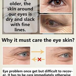 Under Eye Patches (60Pcs) - Upgraded Eye Mask Retinol & Collagen, Eye Treatment Mask, Under Eye Bag Treatment, Eye Masks for Puffy Eyes, Anti-Aging, Anti-Wrinkle and Fine Lines, Under eye Dark Circles