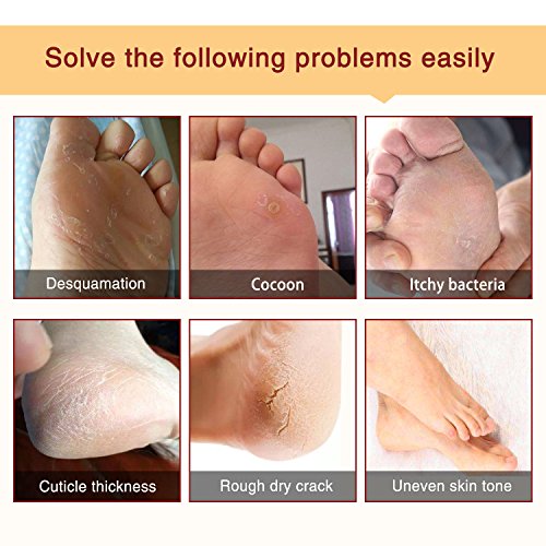 Foot Peel Mask 3 Pack， Exfoliator Peel Off Calluses Dead Skin Callus Remover，Baby Soft Smooth Touch Feet-Men Women (Lavender)