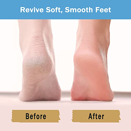 Sptcckare Moisturizing Socks Lotion Gel for Dry Cracked Heels, Spa Gel Socks Humectant Moisturizer Heel Balm Foot Treatment Care Heel Softener Sock (1 Pair)