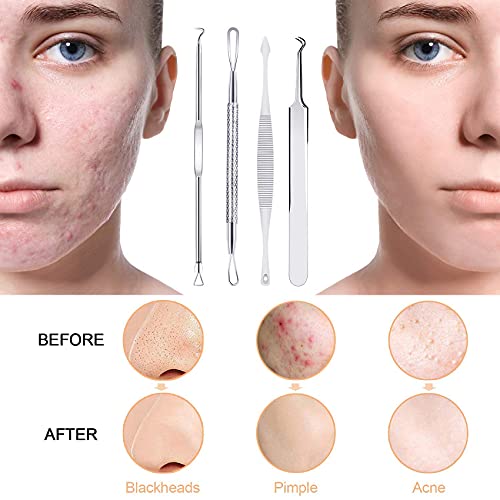 Pimple Popper Tool Kit,MENOLY 10Pcs Blackhead Remover Tools,Pimple Extractor,Acne Tools,Acne Kit for Blackhead,Blemish,Zit Removing,Whitehead Popping and Comedone Extractor Tool with Leather Bag