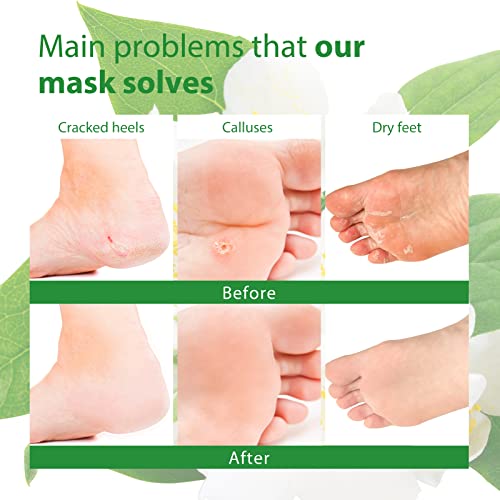 Foot Peel Mask, Exfoliating Foot Masks For Dry, Cracked Feet, Callus, Dead Skin Remover Foot Peeling Masks For Baby Soft Feet Repair Rough Heels, 3 Pairs, Jasmine